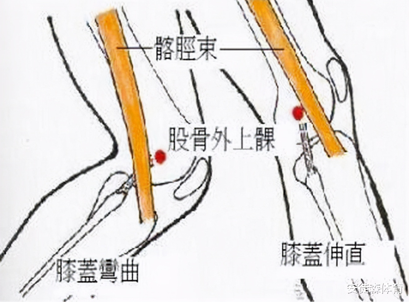 膝盖外侧痛的锻炼方法,膝盖外侧痛怎么贴肌肉贴