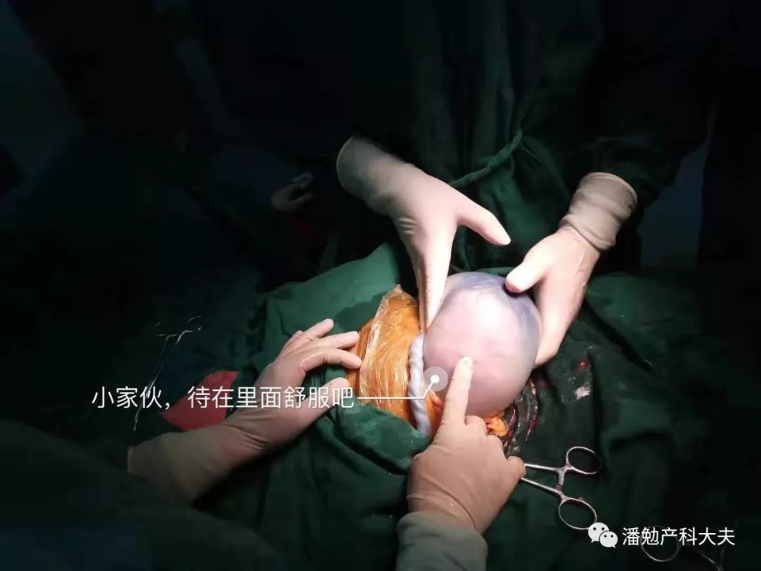 36岁的三明少妇小玲：诞下“带壳宝宝”，男婴像个透明鸡蛋