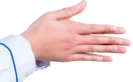 寒冷天气预防冻疮措施,寒潮来袭防寒