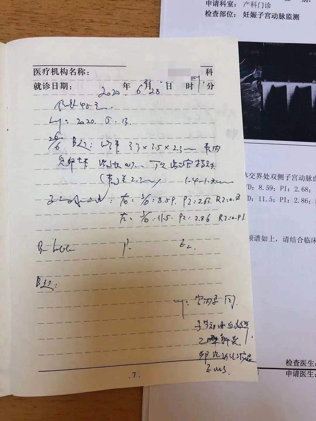 多次生化妊娠成功案例,人流后连续两次生化妊娠