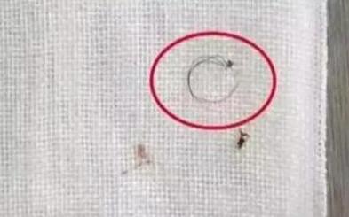 四岁孩子脚趾疼得很厉害,4岁孩子脚趾