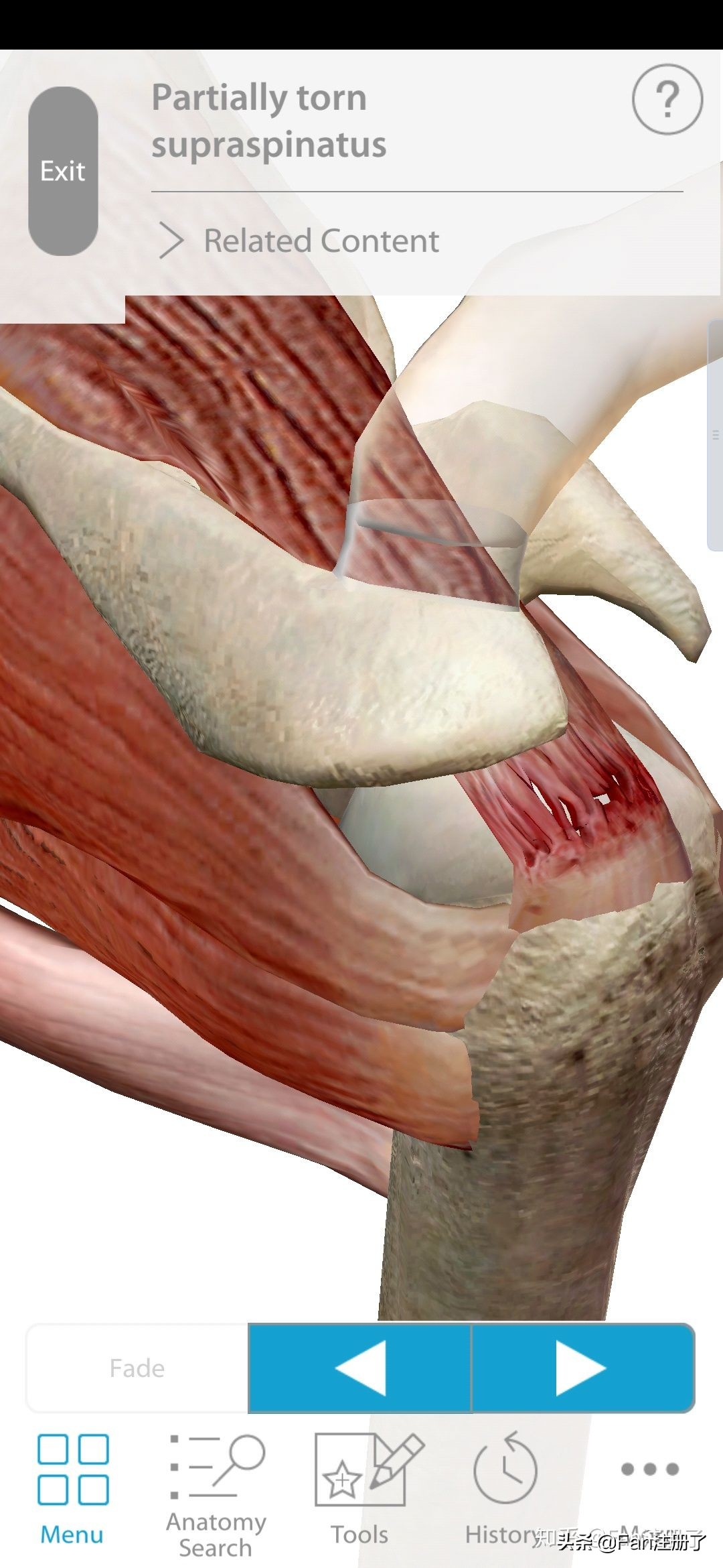 肩关节挫伤脖子痛,肩部肌肉扭挫伤怎么办