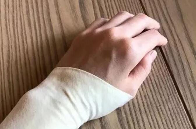 带宝宝手腕疼需要看医生吗,带孩子手腕一直痛怎么办