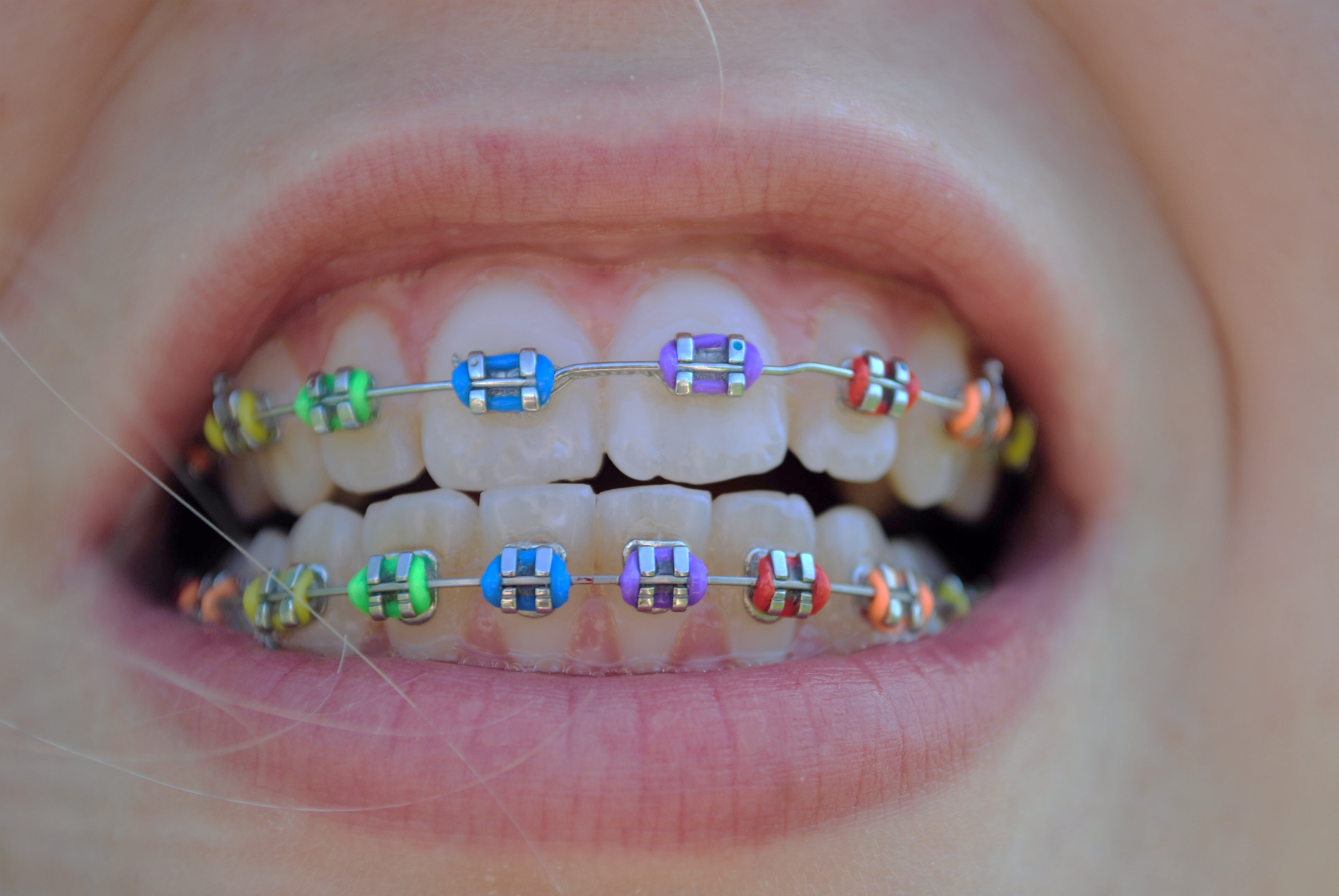 可怕的牙齿治疗,可怕的牙齿蛀牙