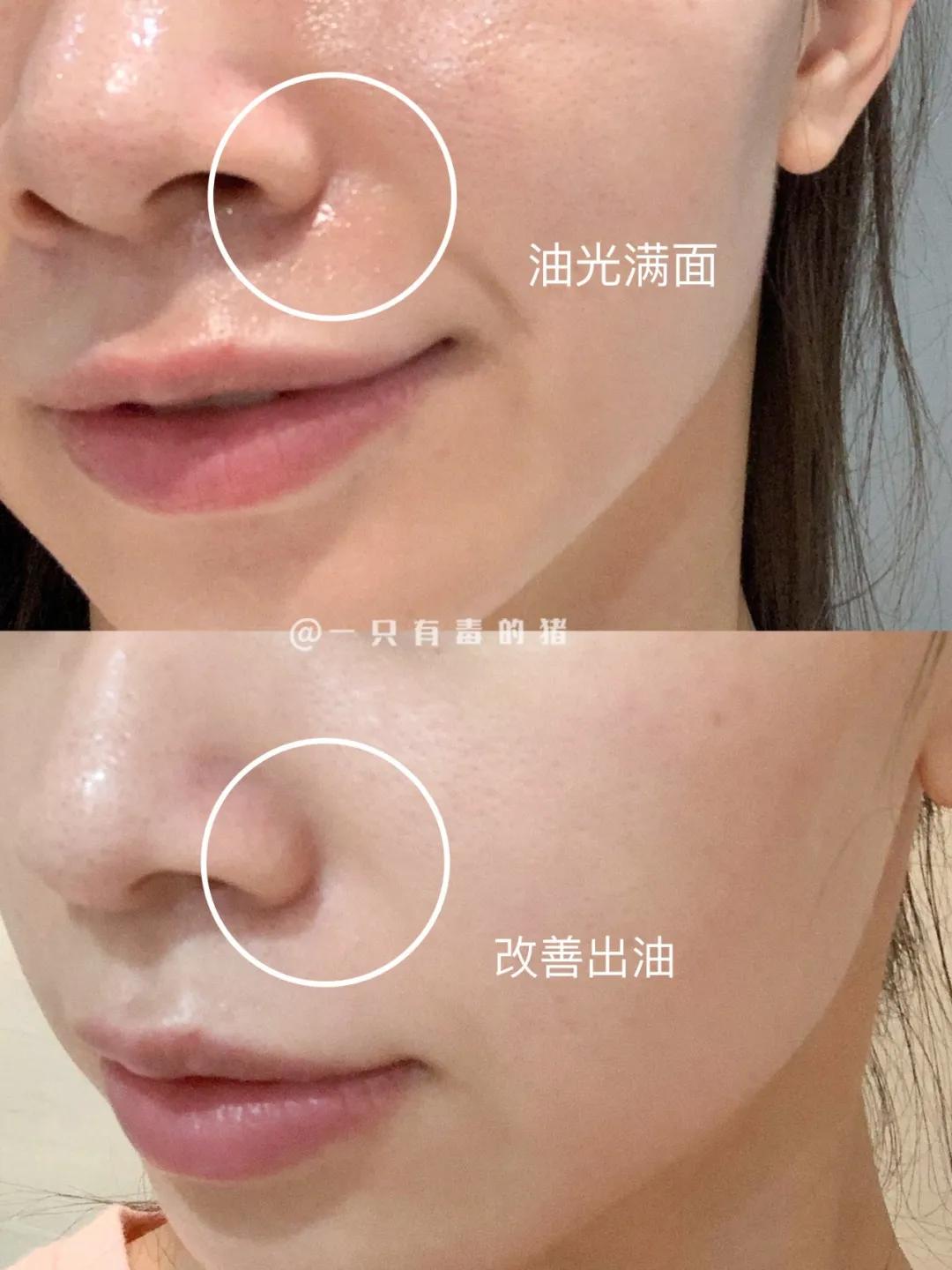 大油田收缩毛孔爽肤水,男士大油田爽肤水