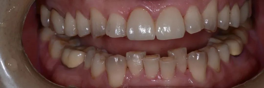 牙医从业感悟,牙医忠告11条