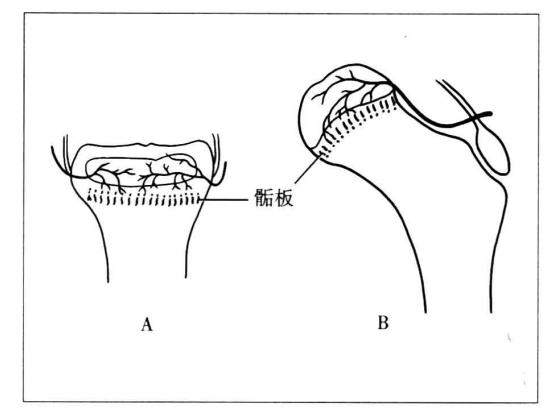 小孩腿部骨折后对身高有影响么,小孩骨折长大后有影响吗