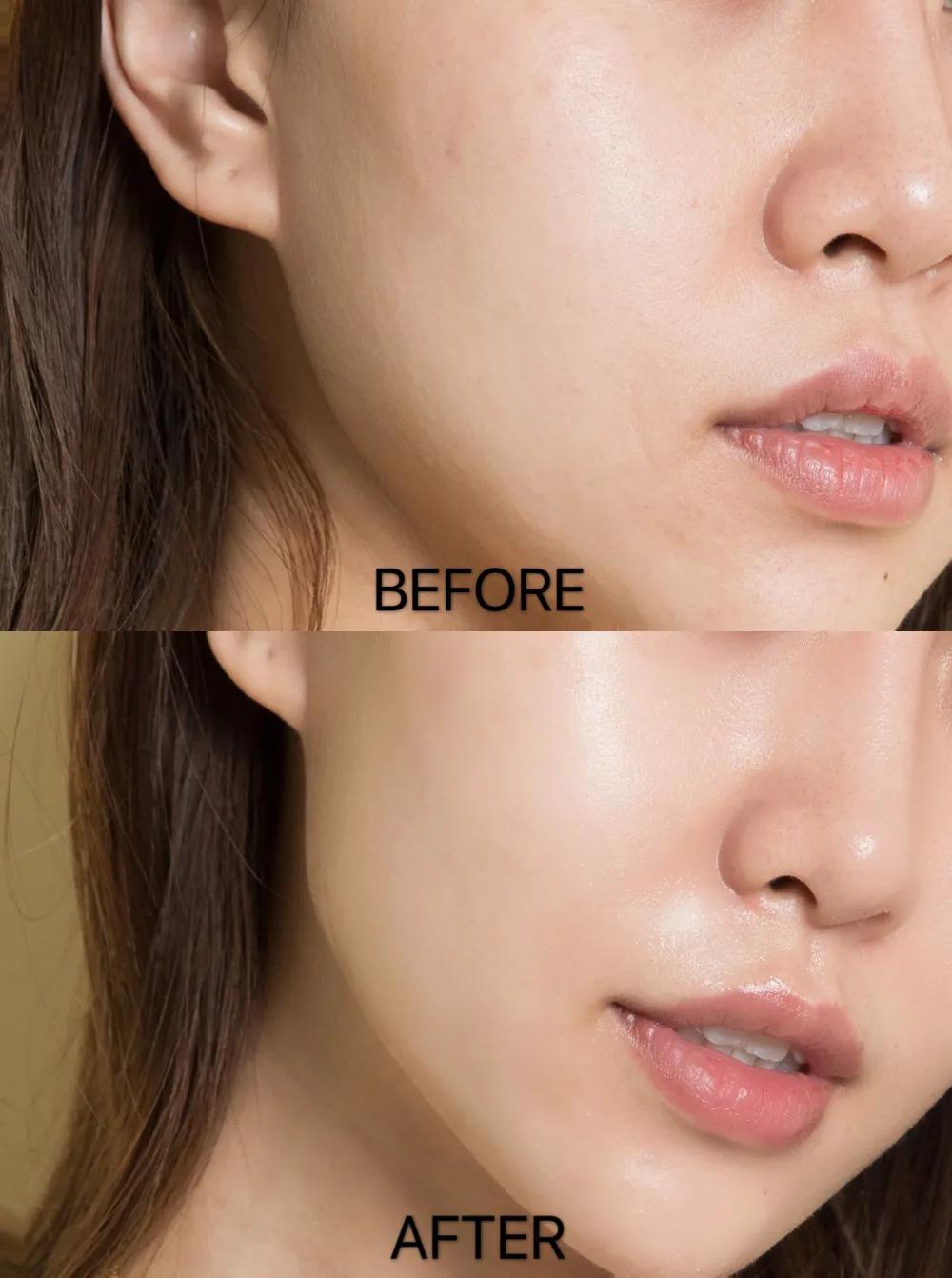 闭口肌福音|黛珂紫苏水#牛油果乳液