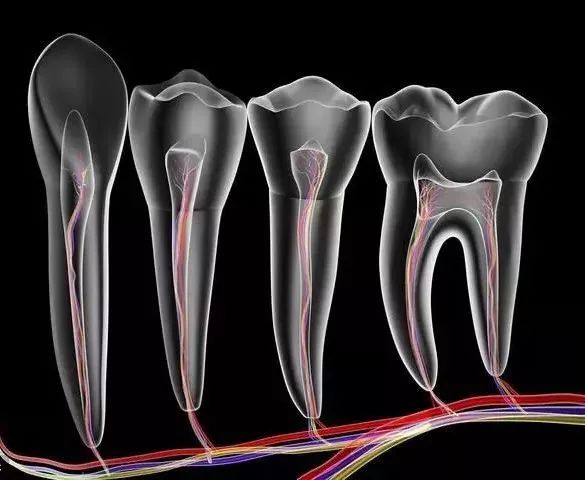 不进行根管治疗就补牙会怎么样,补牙杀神经和根管治疗是一回事吗