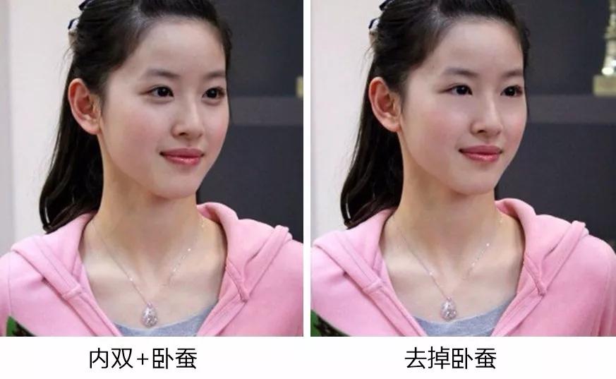 怎么让自己的内双更明显,如何让内双变得更明显小技巧