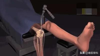 长腿秘诀大全图解,原来大长腿是这样炼成的