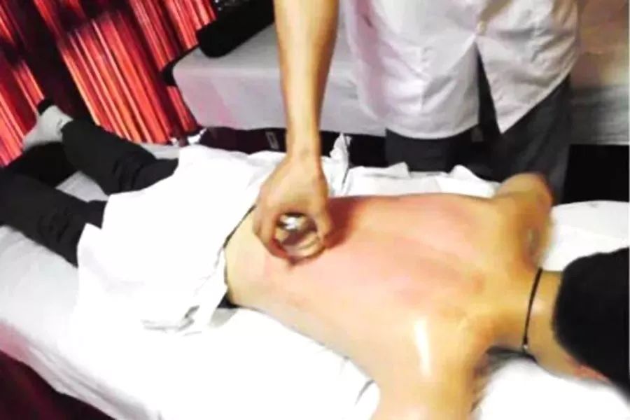 拔罐留罐闪罐走罐,拔罐祛湿有效果吗