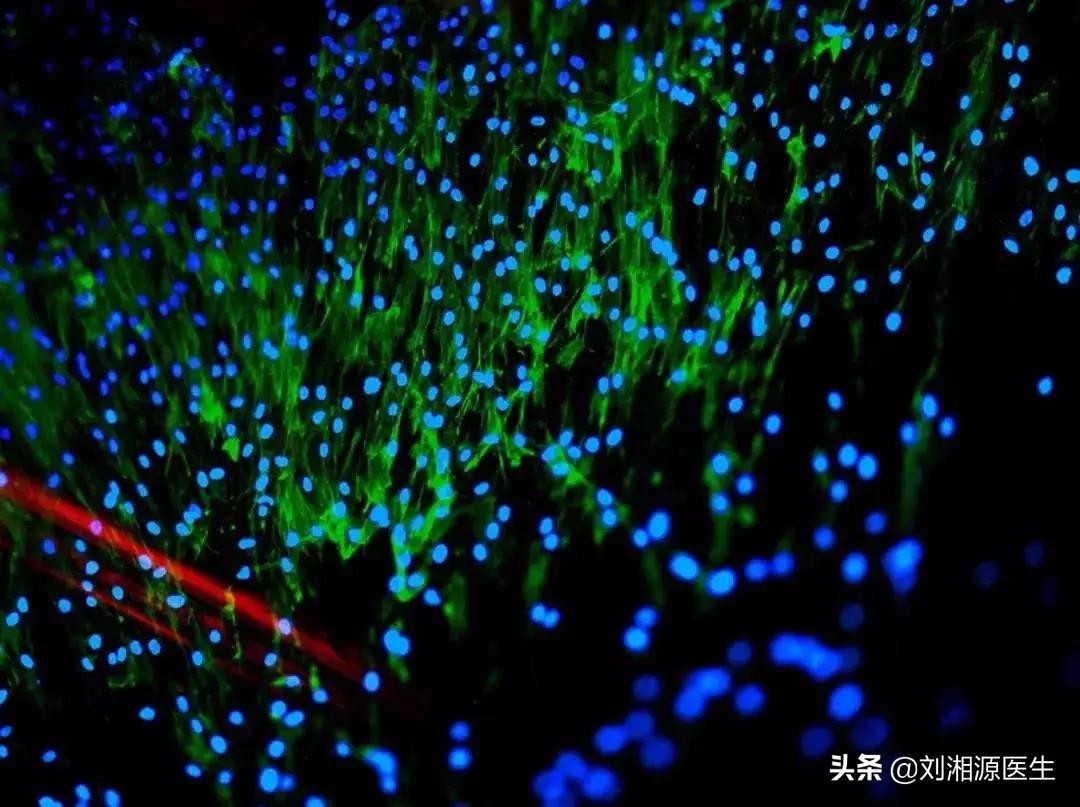 免疫相关高危妊娠,免疫相关不良妊娠答疑