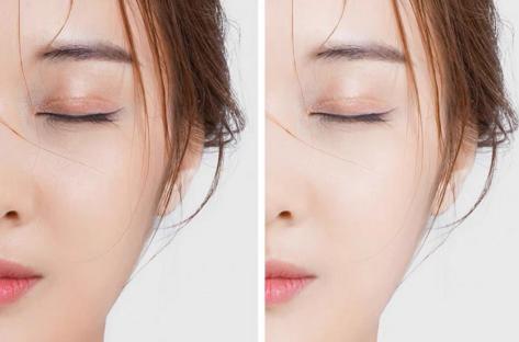 敷面膜需要把上面的塑料纸扔掉,敷面膜外面那层塑料纸要不要撕掉