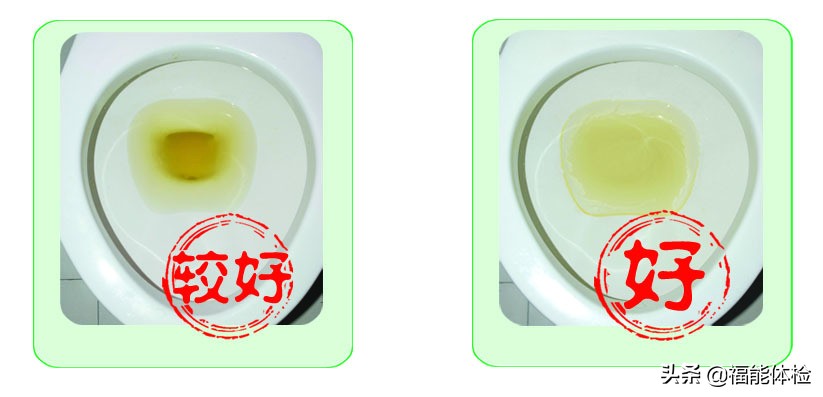 肠镜前清肠的正确方法,做肠镜前清肠的正确方法