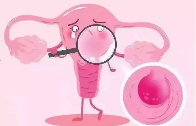 子宫肌瘤的神秘面纱,子宫肌瘤很恐怖只要一招轻松没了