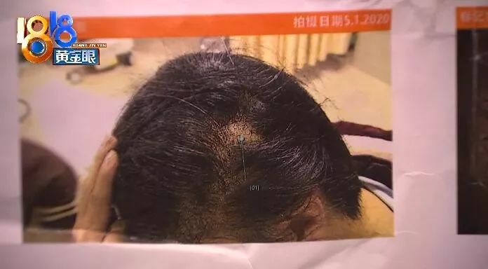 顾客说烫完头发掉头发来找麻烦,烫发顾客觉得没烫好该怎么办