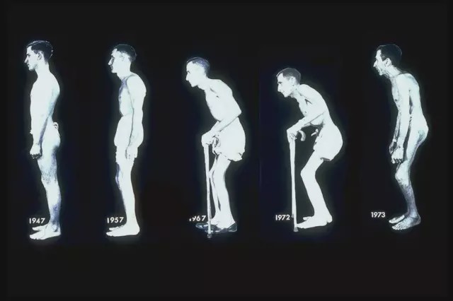 张嘉译不死的癌症,张嘉译为什么放弃治疗