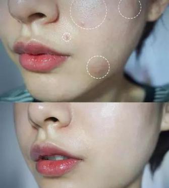 火山泥真是宝，油皮女孩的毛孔疏通剂，让贵妇霜3秒吃透锁水8倍