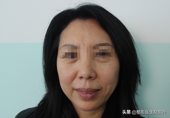 做眼袋用什么护肤品,眼袋大怎么办用什么眼霜好