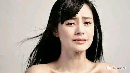 有烂牙但是不痛能直接补牙吗,烂牙不痛还要去补牙吗