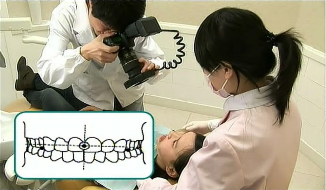 正畸初诊治疗需要验血吗,正畸初诊到戴牙套多久