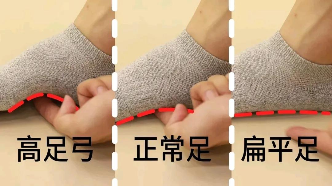 穿袜子走几步路就掉怎么处理,走路袜子总往鞋里脱小妙招