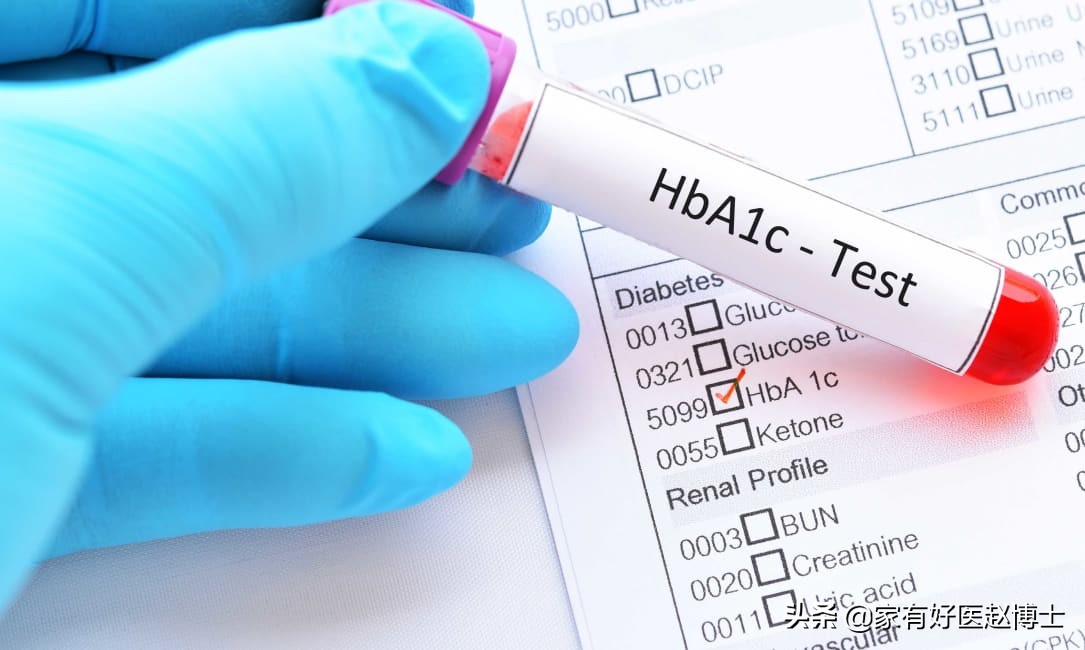 血糖正常的人怎么控制血糖升高呢,医生说糖尿病血糖高是怎么回事