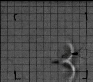 孩子膀胱容量130,儿童最大膀胱容量197正常吗