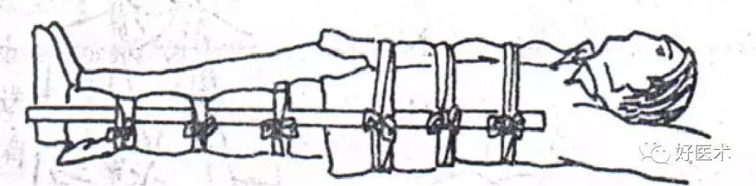 骨科急救处理流程图,骨科急救原则及注意事项