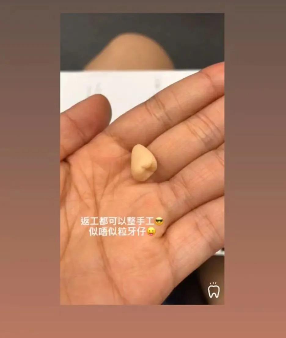 怎么样才能去香港看牙齿,香港哪个牙医最好