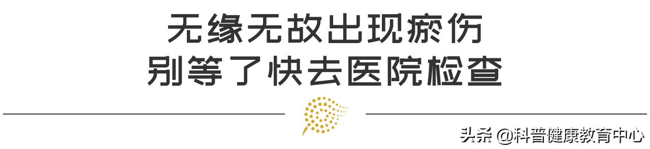 如何用红花油消退瘀青,摔伤淤青不消退是怎么回事