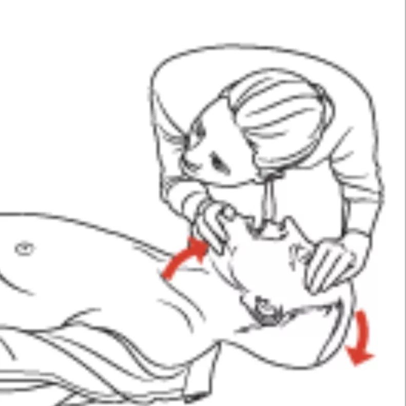 人手必备急救常识之心肺复苏术,急救技术心肺复苏术操作教学视频