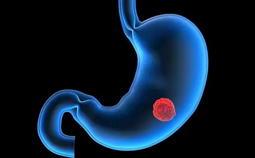 不重视胃炎的后果,肠炎不重视会怎样