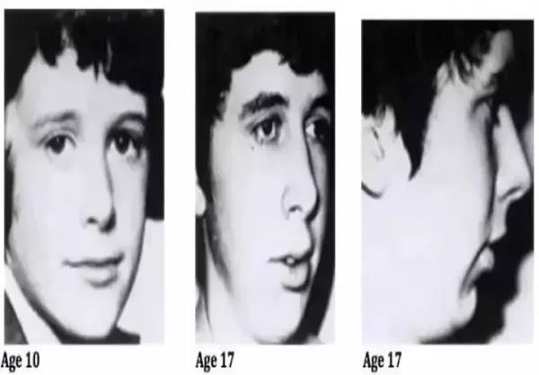 口呼吸贴胶带就会好？可能有风险，专家建议，不要盲目学习