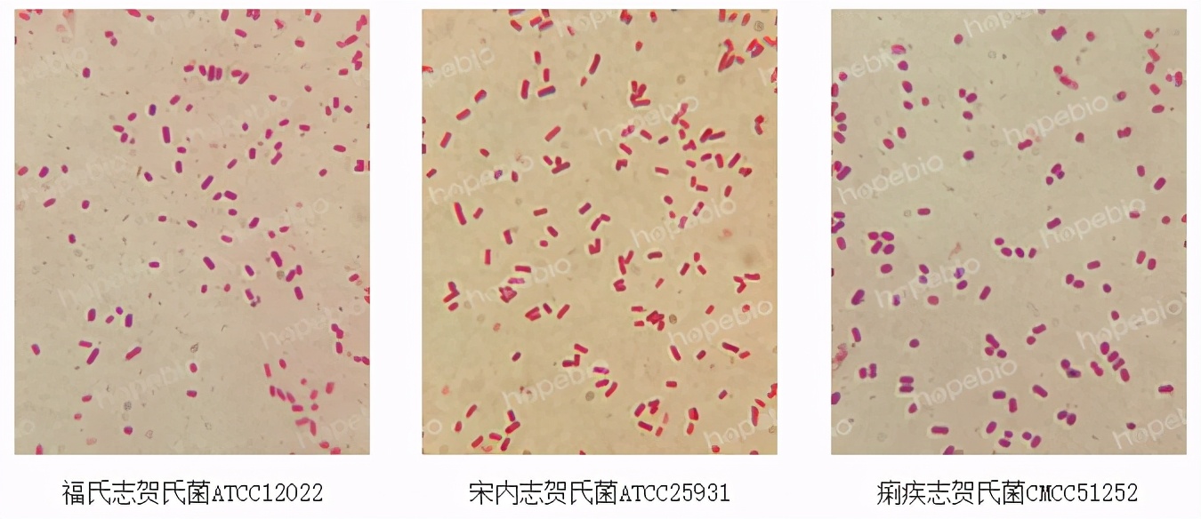 常见细菌的革兰氏染色结果,常见细菌的革兰氏染色结果怎么看