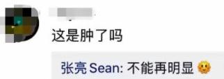 张亮摔伤怎么样,张亮晒受伤照被网友骂