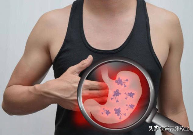 什么是胃癌早期有哪些症状,胃癌是怎么形成和症状