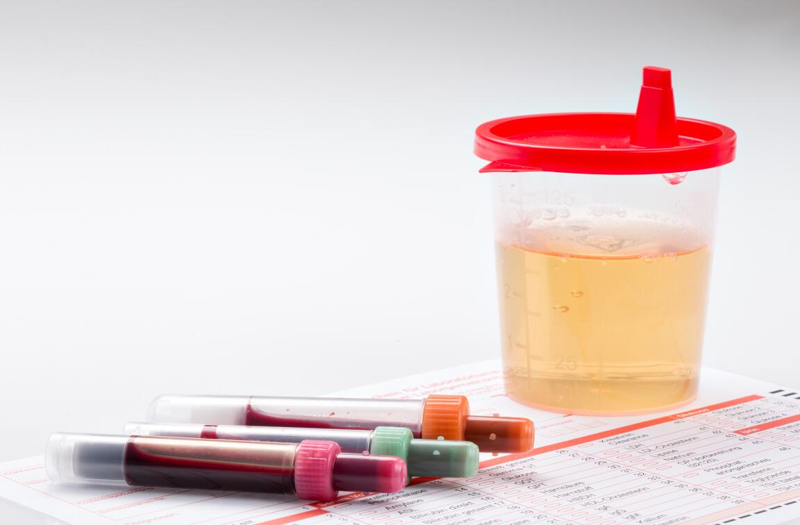 甲亢常见并发症及处理方法,甲亢常用三种治疗方法