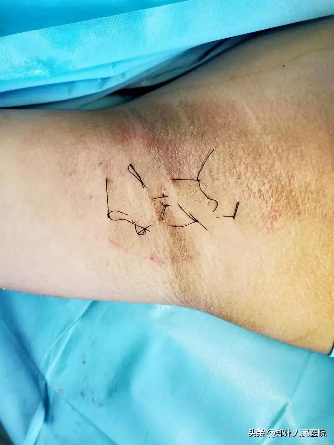 对味道敏感的人怎么办,对味道特别敏感的人真的很崩溃