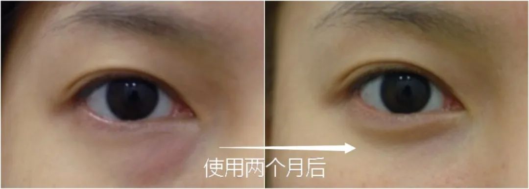 真的神了！抗皱界的最强C位究竟是谁？实验了3个月终于得出了结论