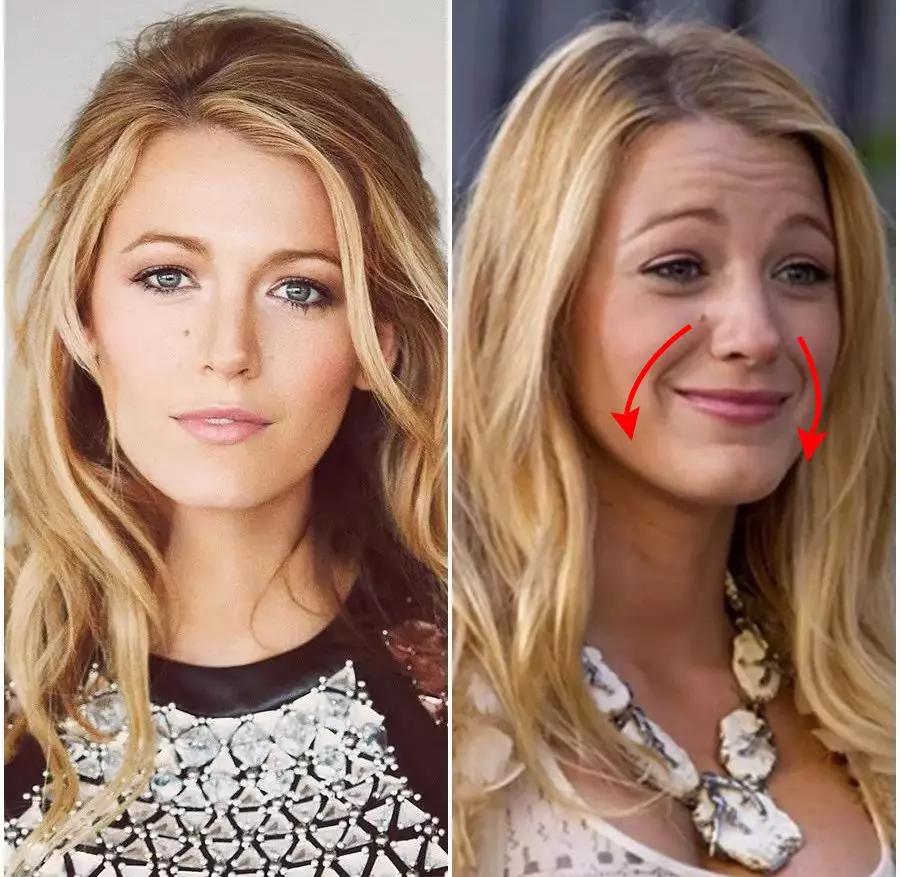 一招帮你搞定淡化法令纹,教你一招二天消除法令纹