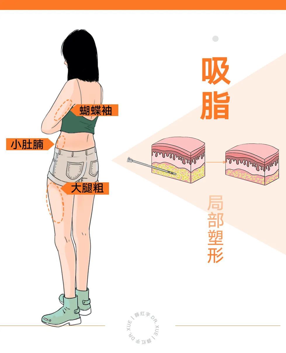 吸脂十天对比图,吸脂整形疑问解答视频大全