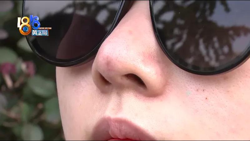 鼻部做了手术如何消除疤,鼻部修复恢复要多久