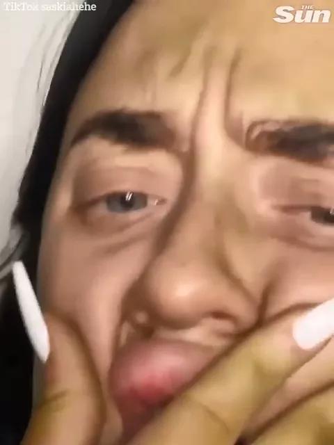 美国妹纸使用过期一年的美黑乳液，全身变绿，自嘲变成怪物史莱克