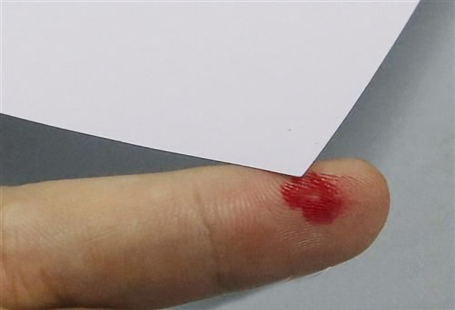被纸割伤了怎么办,为什么被纸割伤比刀割伤痛