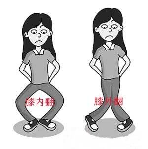 ox形腿是什么样子,ox腿型真的能矫正吗