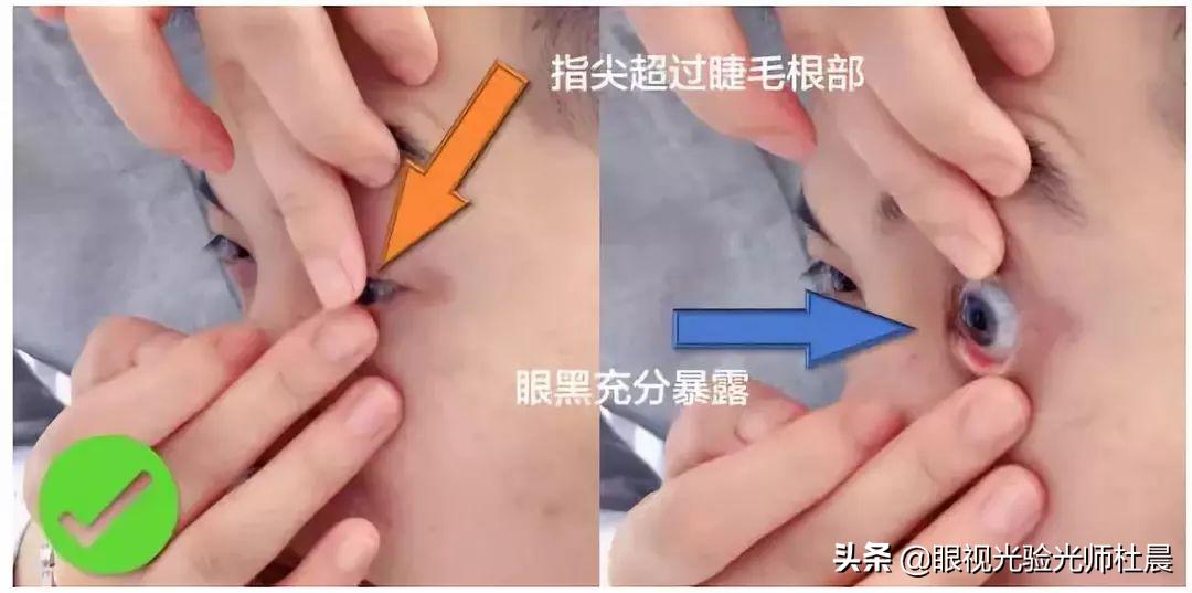 初次戴隐形眼镜的技巧,戴隐形眼镜眼睛注意事项