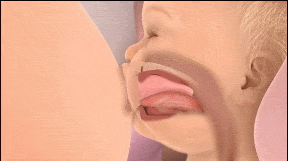 哺乳期早期乳腺炎要怎么处理,哺乳期乳腺炎初期怎样治疗最快