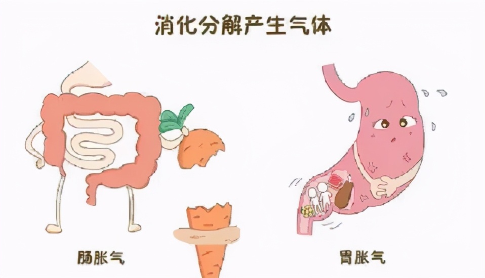 憋回去的屁会变成打嗝吗,憋回去的屁会消失在身体内部吗